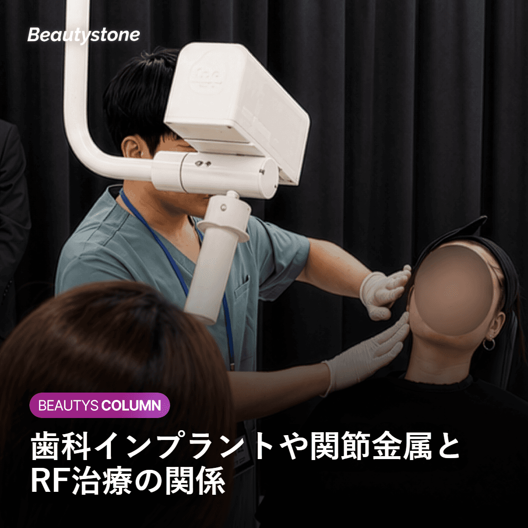 歯科インプラント・関節金属・その他金属がある場合