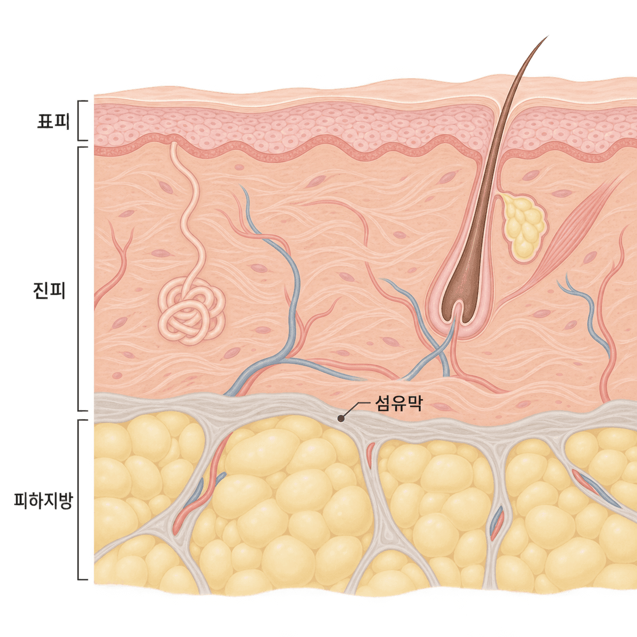 진피와 피하지방, 그 사이를 나누는 섬유막의 자리예요