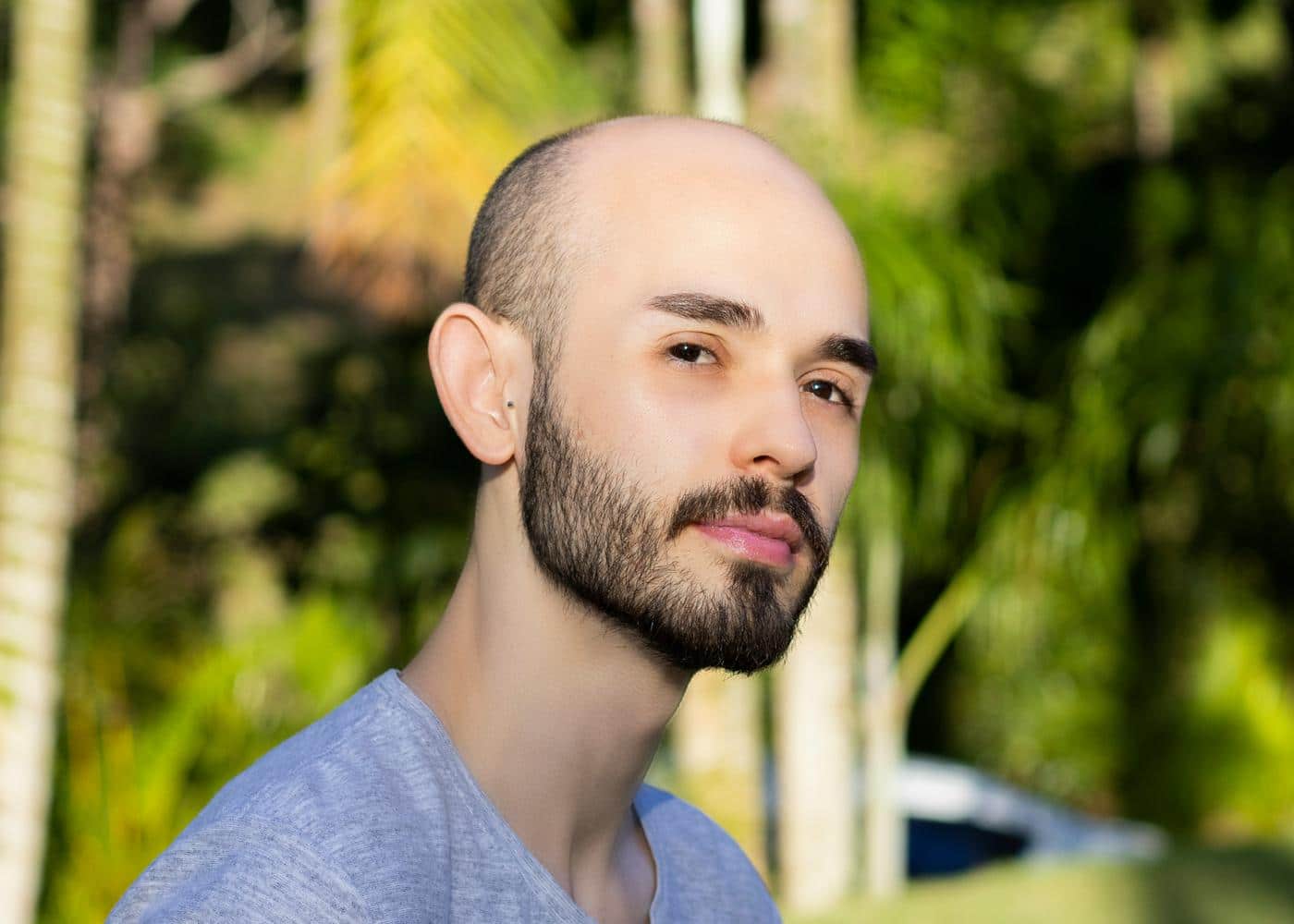 Red light hair treatment - man with male pattern baldness