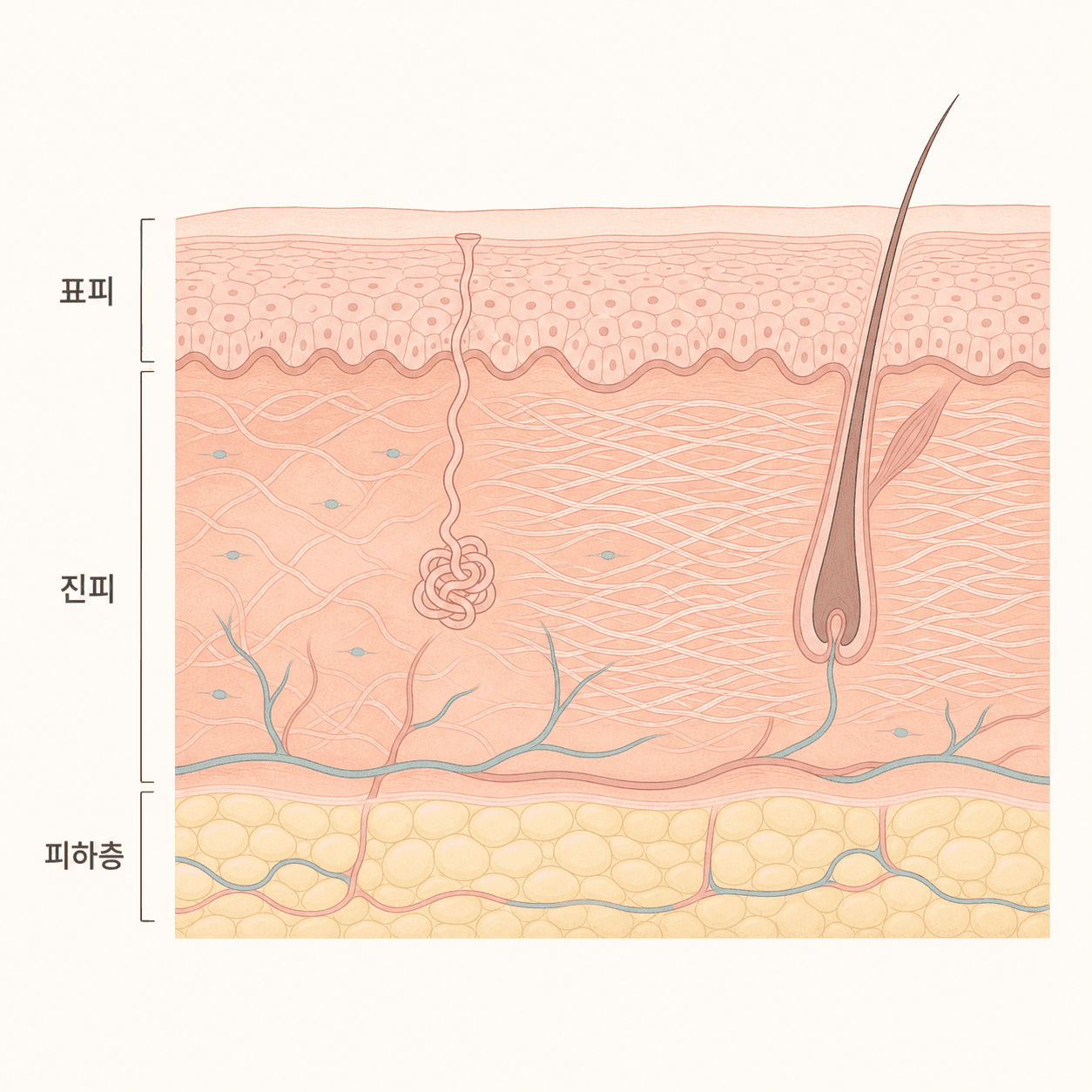 진피층에서 다시 짜이는 콜라겐 섬유의 그물망
