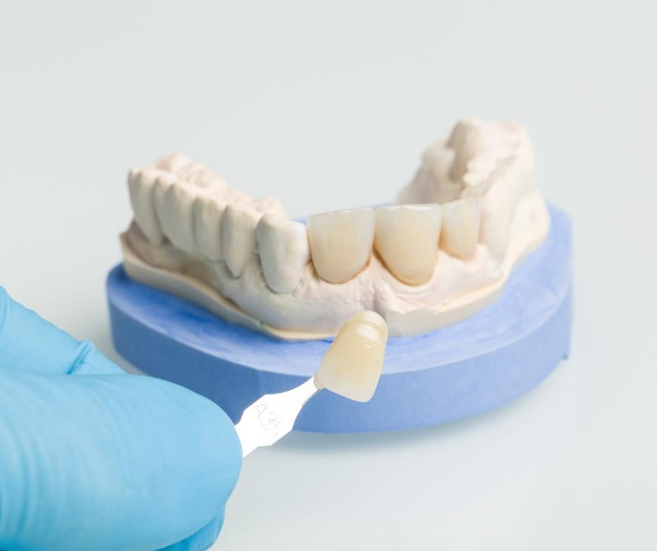 Radiographie d’une mâchoire avec perte osseuse