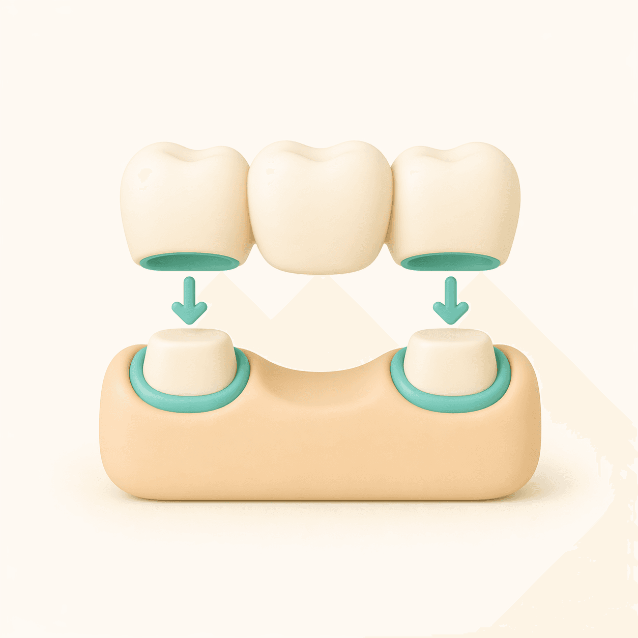 prosthetics illustration