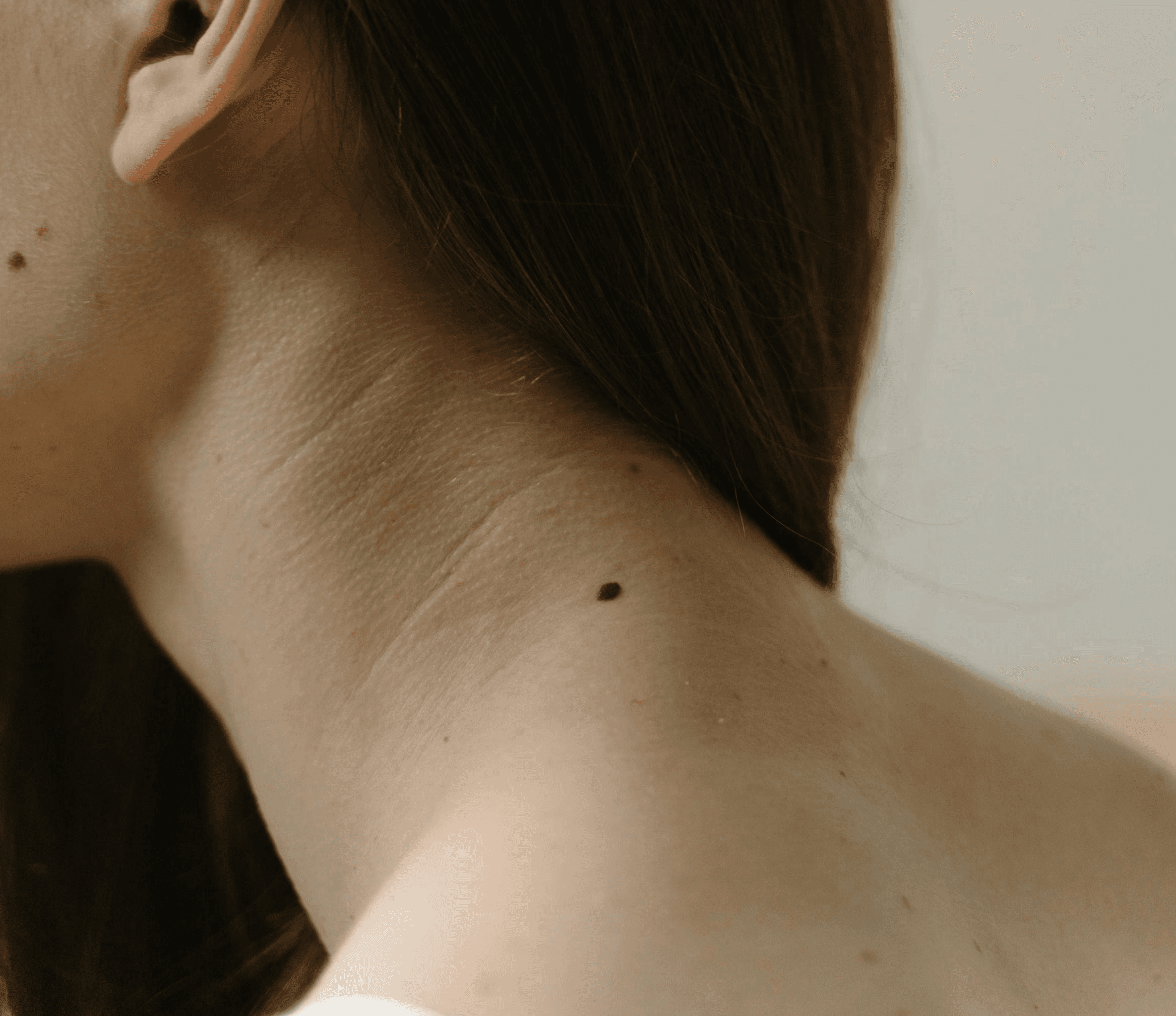 Laser treatment on woman's cheek with protective eye shield