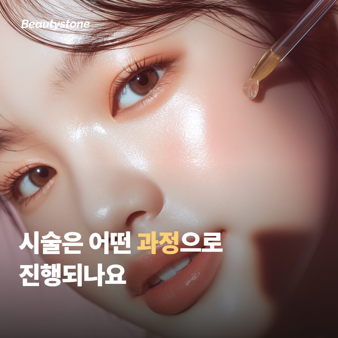 시술은 어떤 과정으로 진행되나요