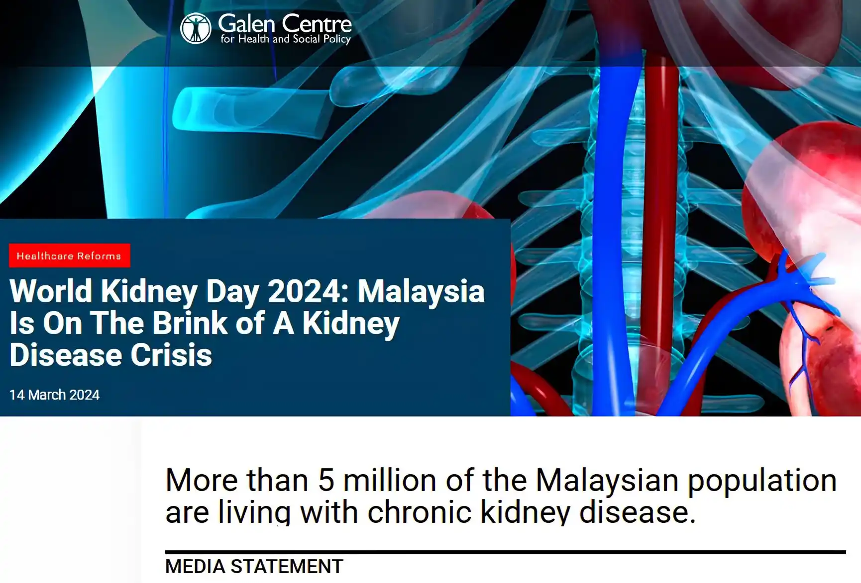 Laporan media Galen Centre mengenai krisis 5 juta rakyat Malaysia menghidap penyakit buah pinggang kronik CKD pada tahun 2024 sebagai amaran awal kepentingan air alkali Kangen Water K8.