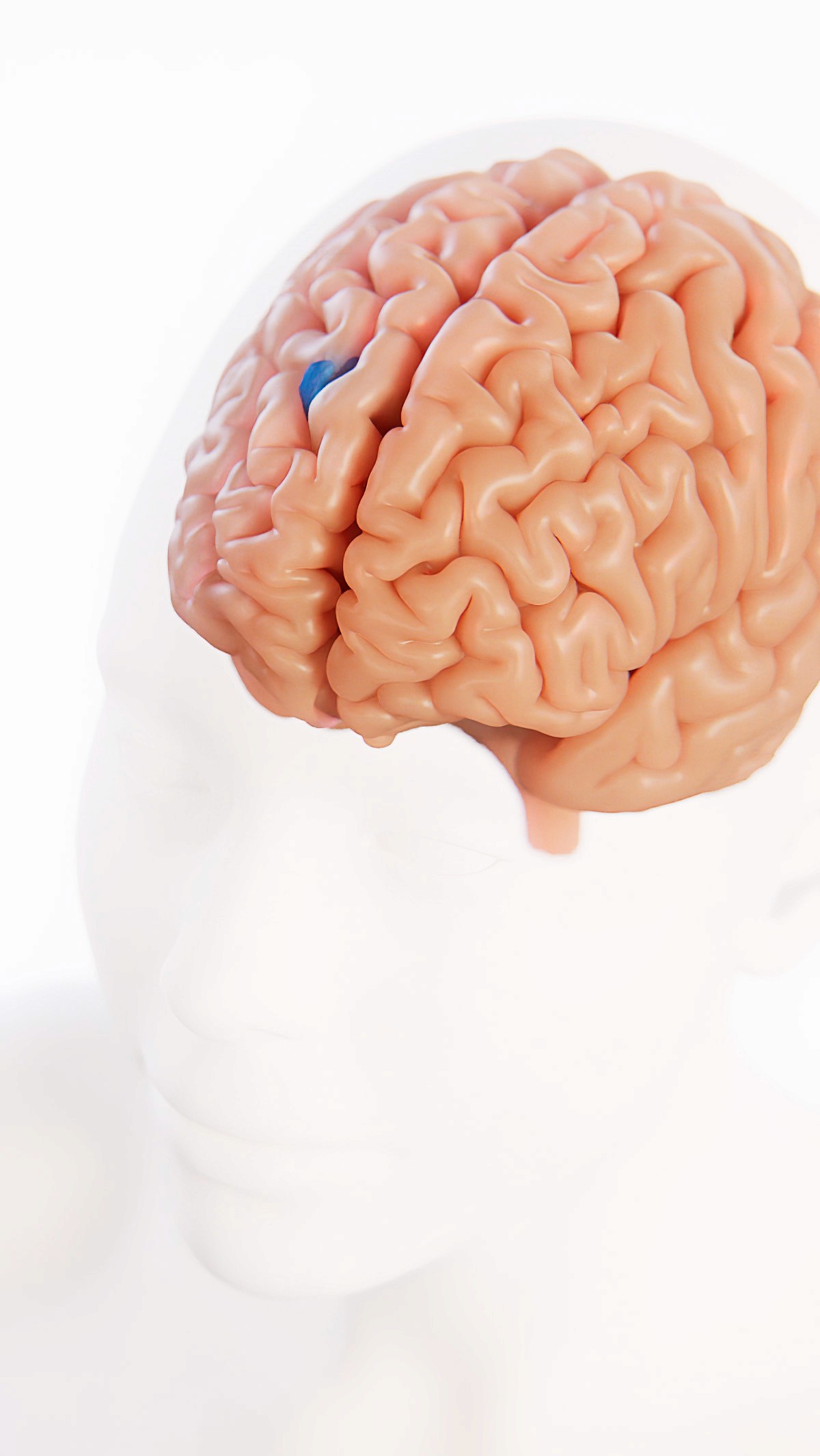 Human brain 3D render with glioma site