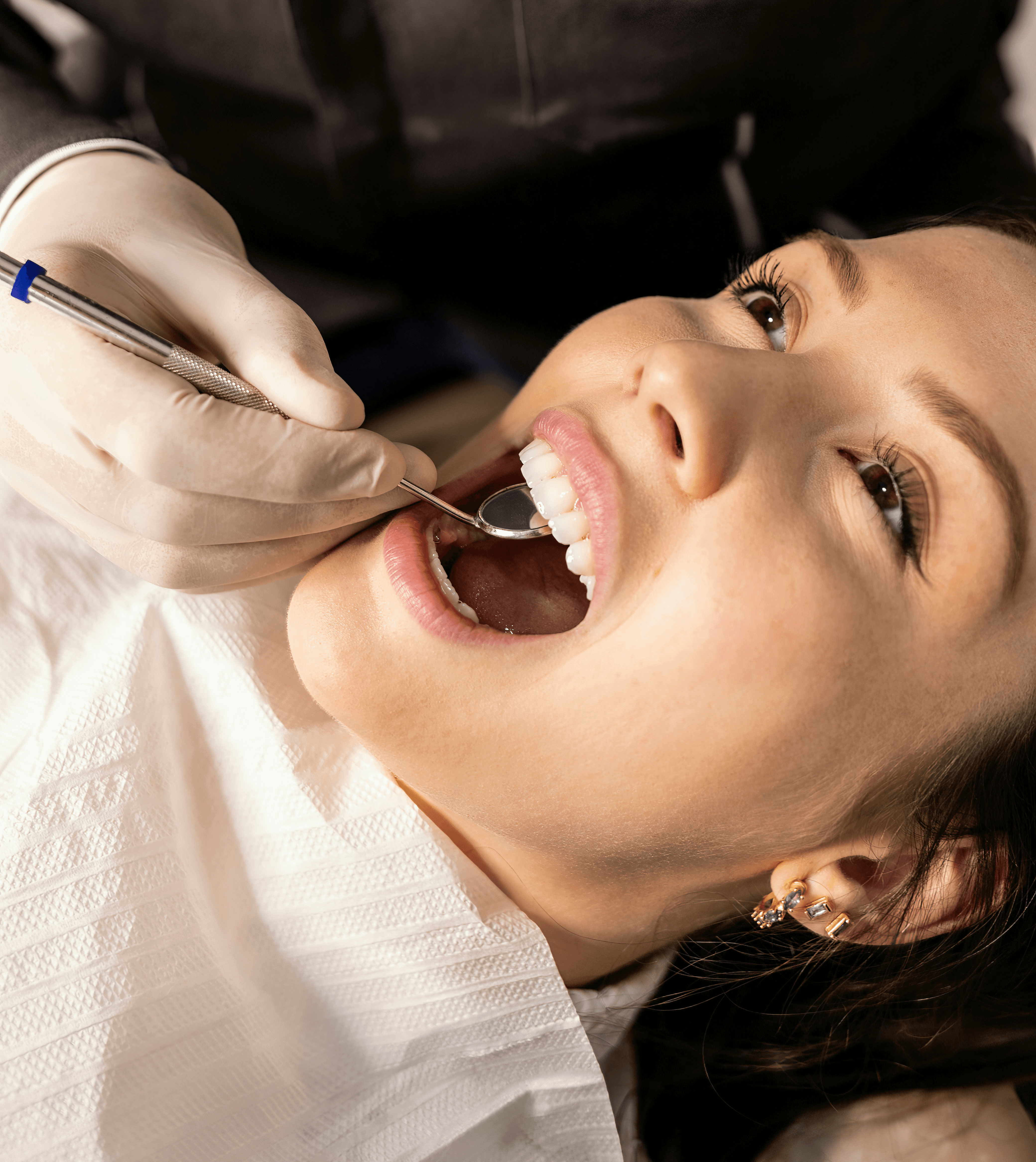 Tooth Extractions