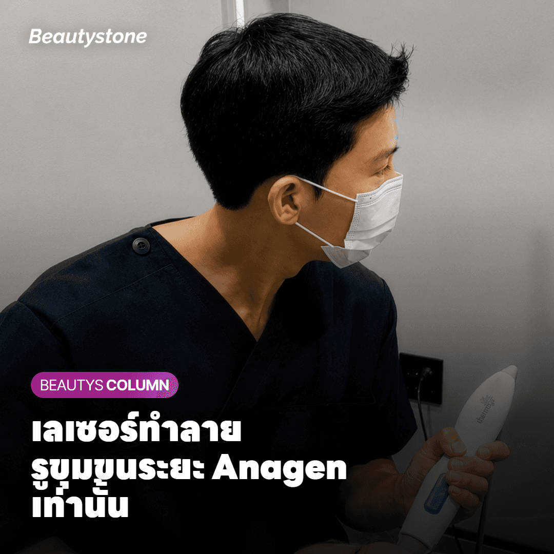 ภาพตัดขวางแสดงรูขุมขนในระยะ Anagen และการทำงานของเลเซอร์ Gentlemax Pro Plus