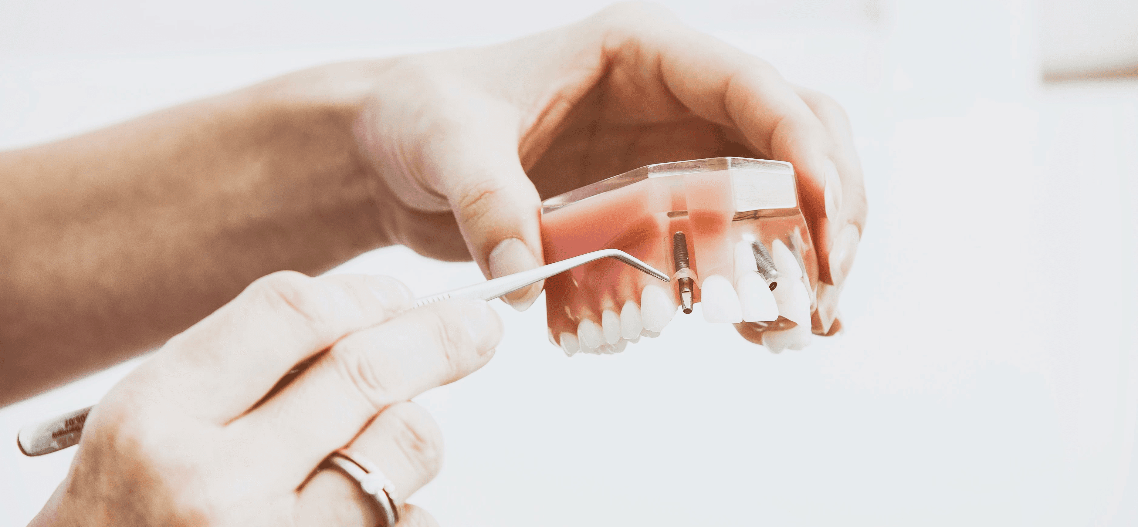 person wearing silver-colored ring while holding denture
