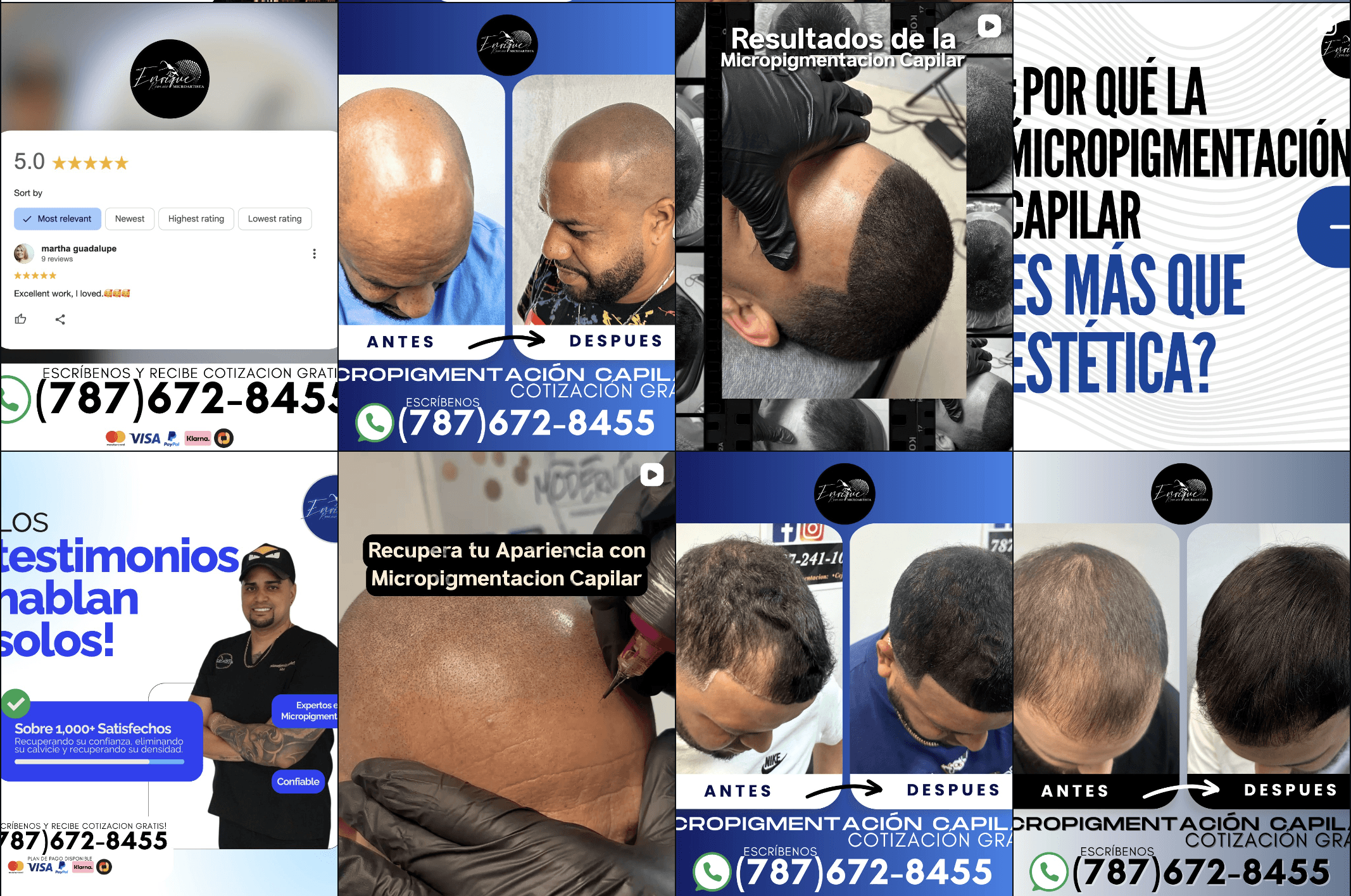 Meta Ads dashboard showing over 5,000 qualified leads for scalp micropigmentation clinic.