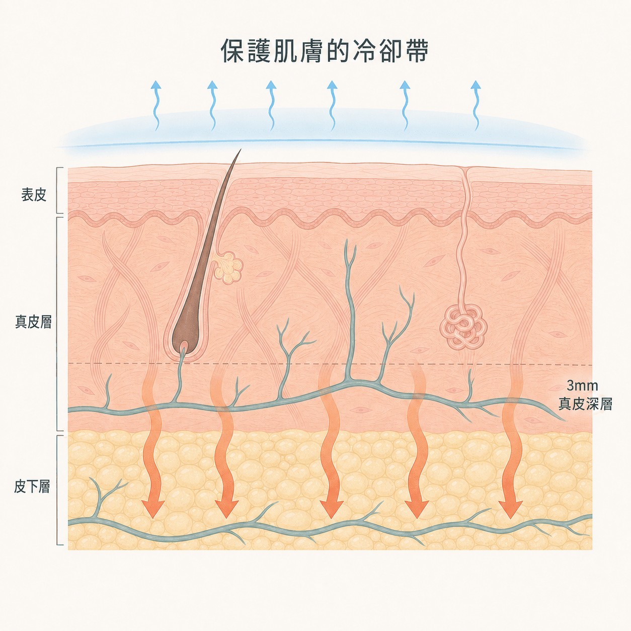 透視熱能作用的肌膚層級