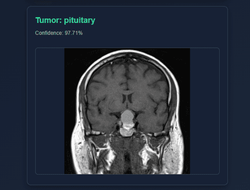 MRI Brain Tumor Diagnosis