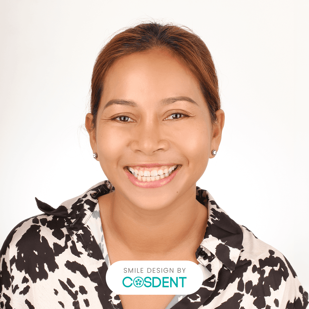 หน้าไทย ยิ้มกว้าง 19 ซี่