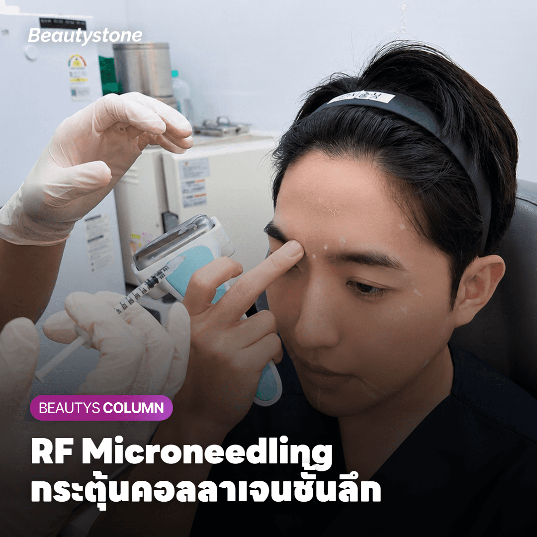 แผนผังแสดงกลไก RF Microneedling กระตุ้นคอลลาเจนในชั้นผิวหนัง