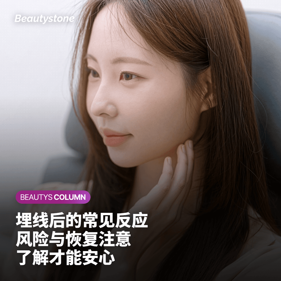 当埋线不是答案时：替代方案参考