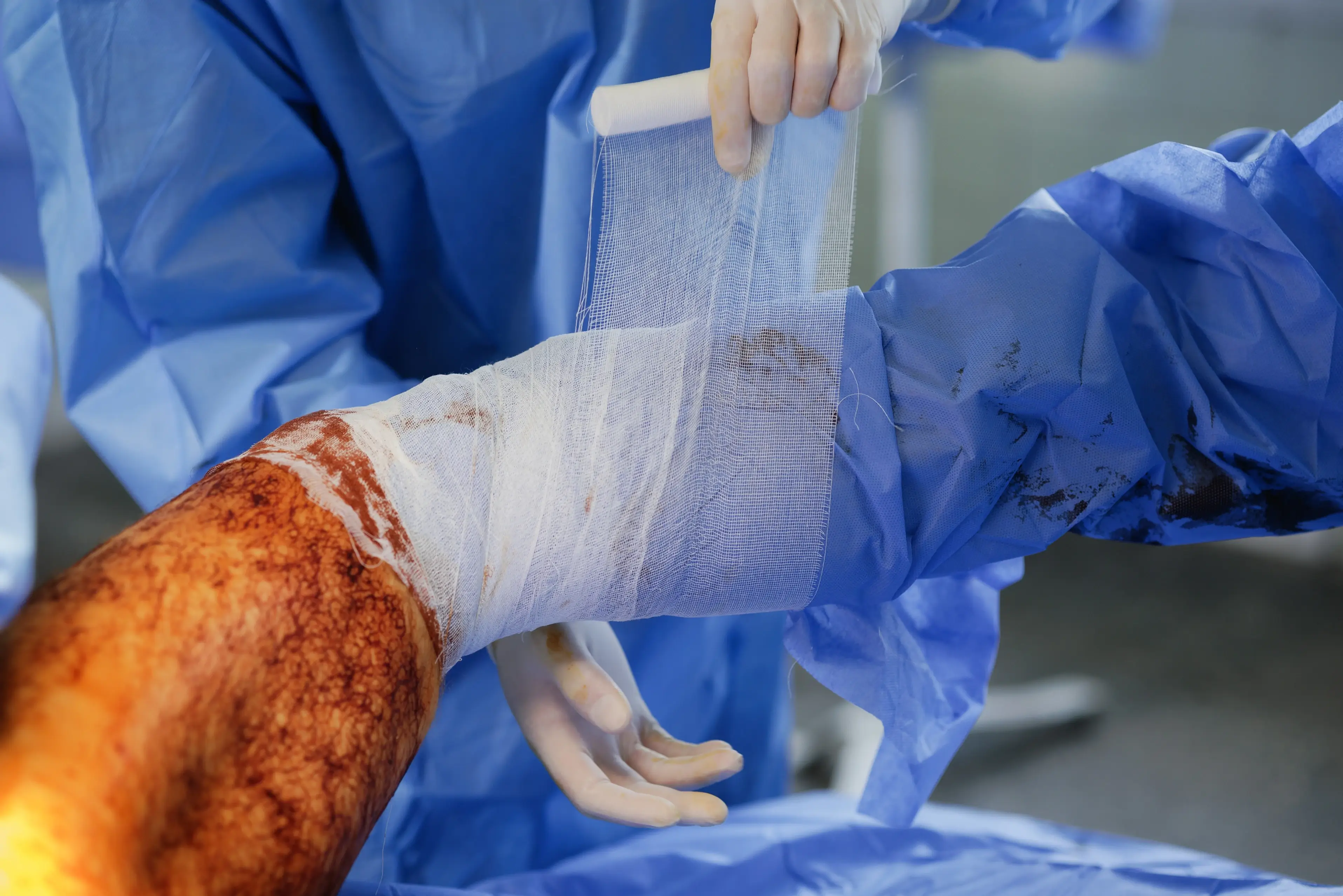 Clinical team performing post-operative wound dressing as part of orthopaedic recovery care