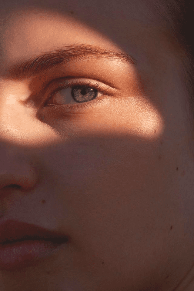 Relleno de ojeras en Terrasa, Heaven Clinics