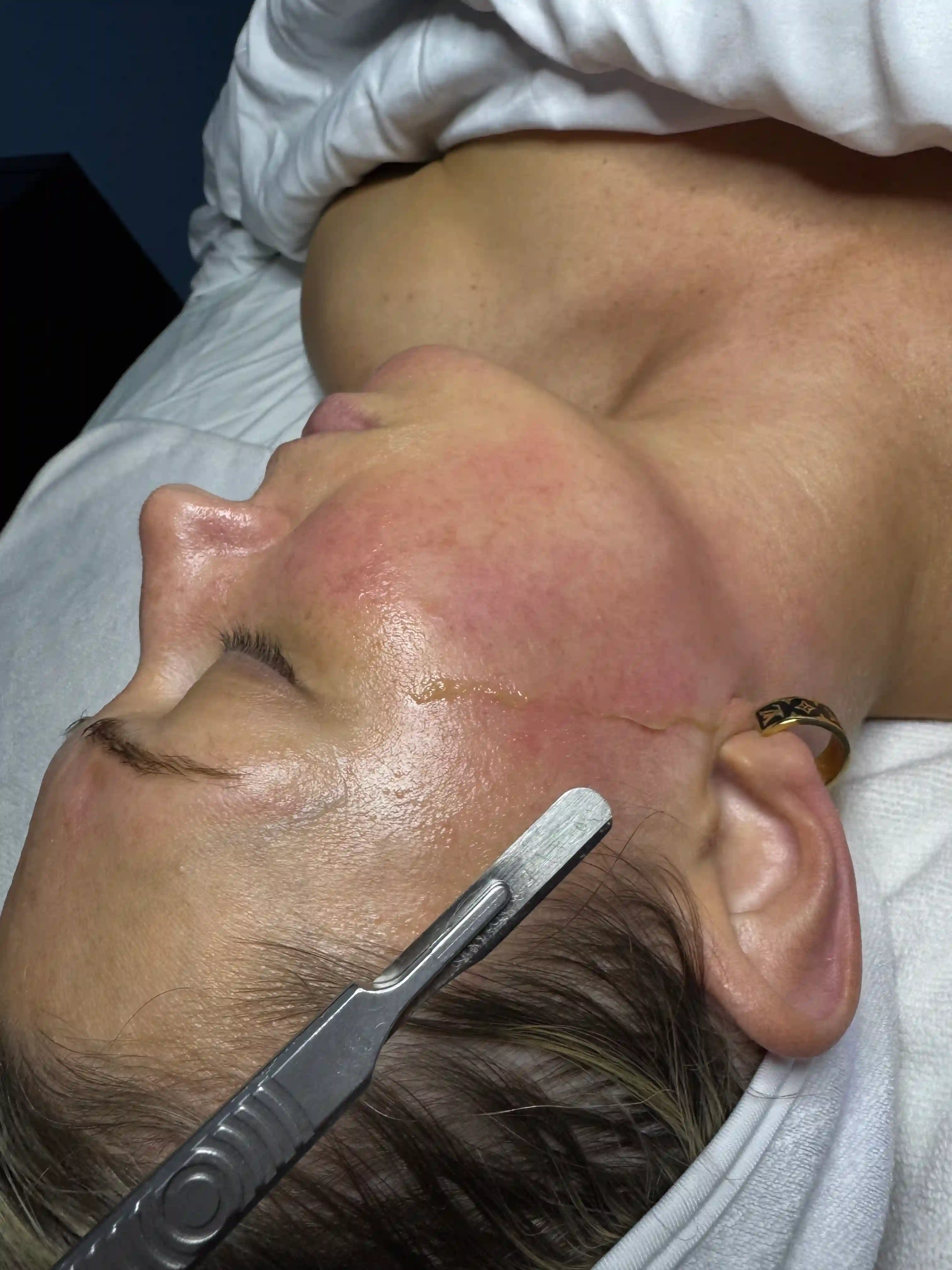 Marissa performing Dermaplaning Facial