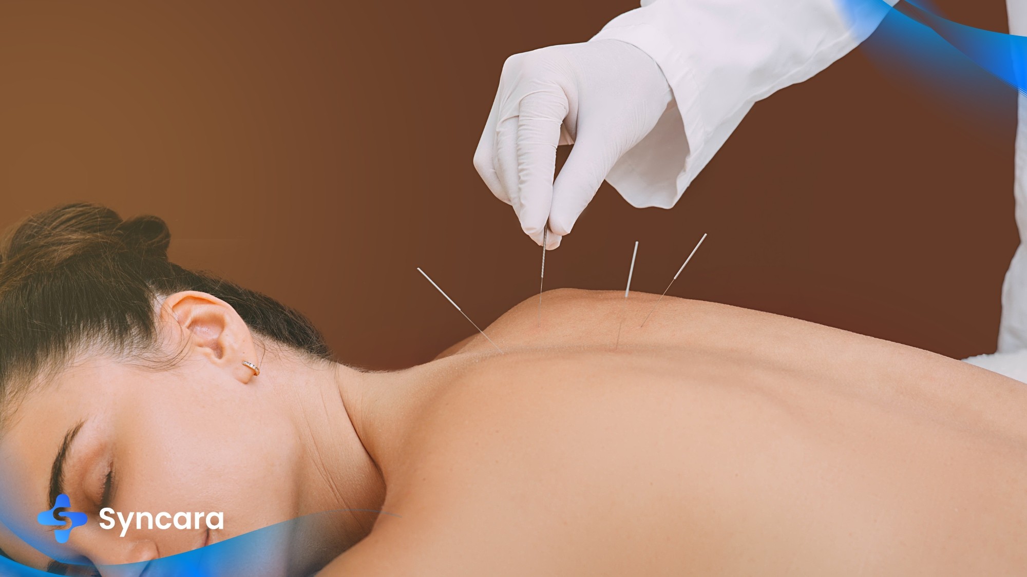 Professional acupuncture treatment in Markham clinic