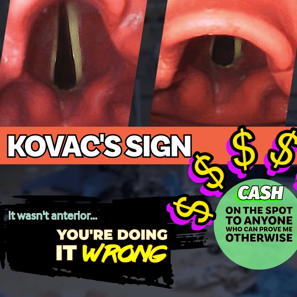 Kovac's Sign