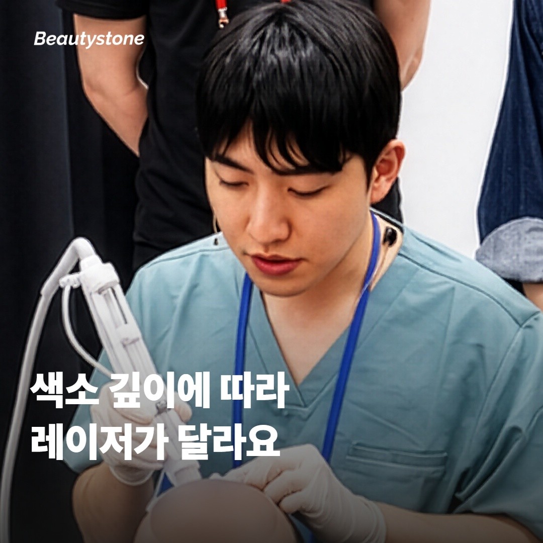 색소 깊이에 따라 레이저가 달라지는 이유