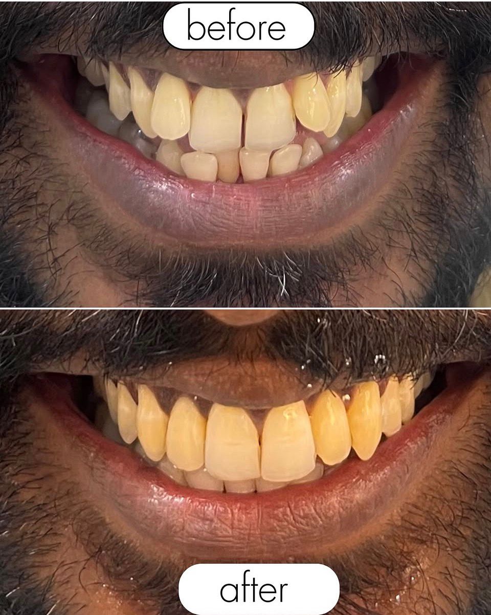 a dentist examining a patient