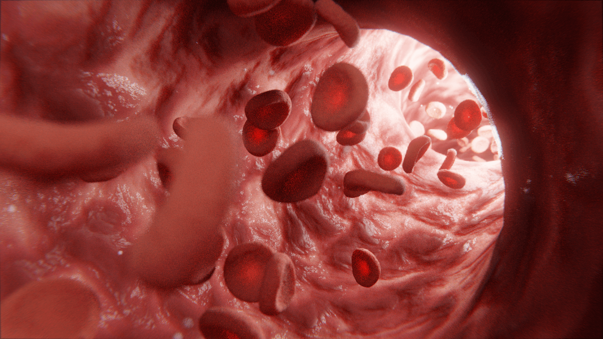 3D facial illustrations for medical syndromes and genetic diseases, showcasing detailed anatomical features and conditions for educational and visualization purposes.