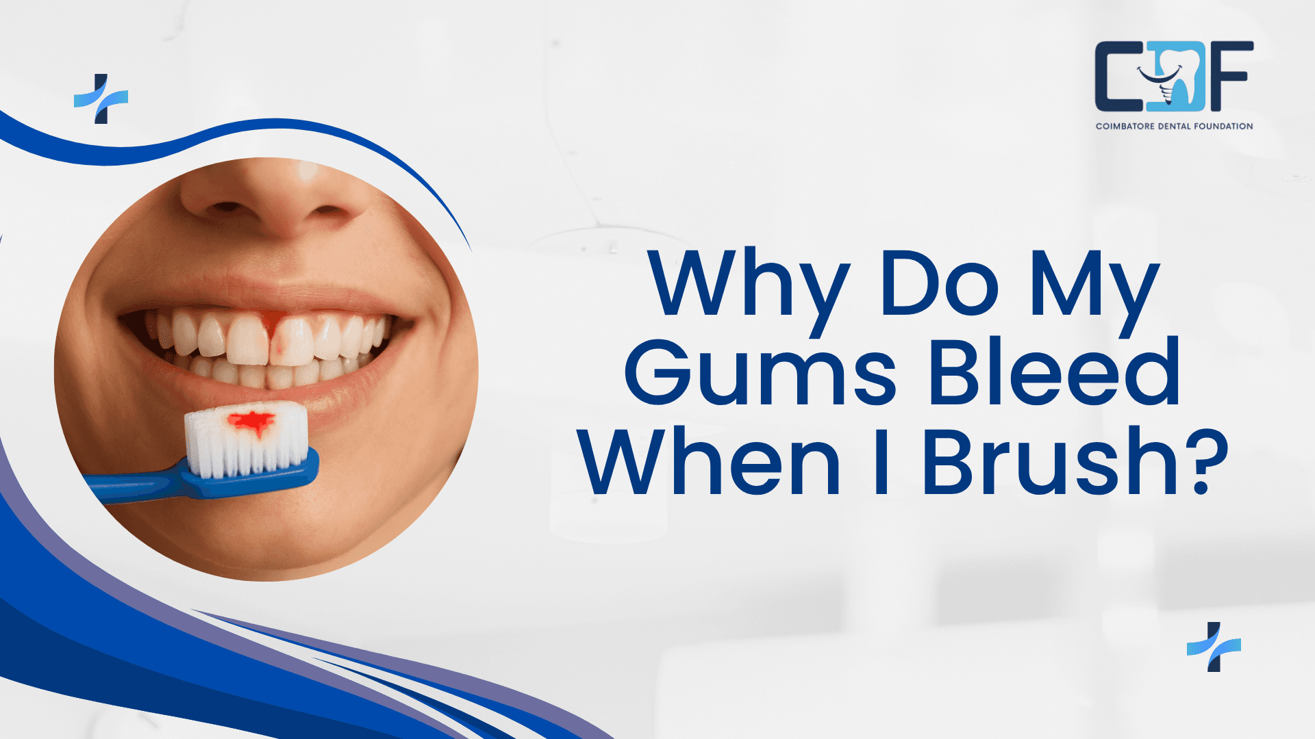 Why Do My Gums Bleed When I Brush | Best Dental Clinics