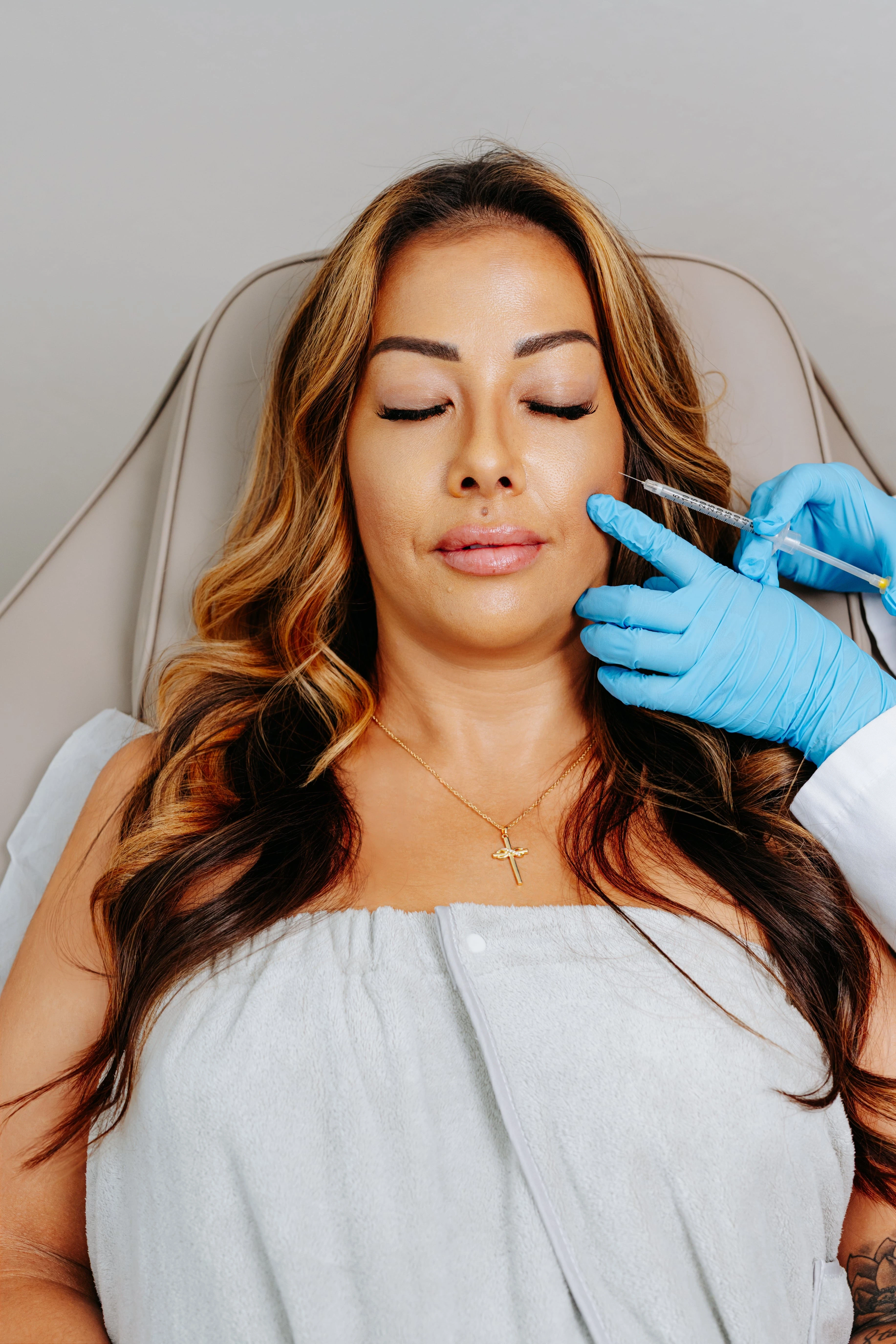 Botox injection results showing natural wrinkle reduction