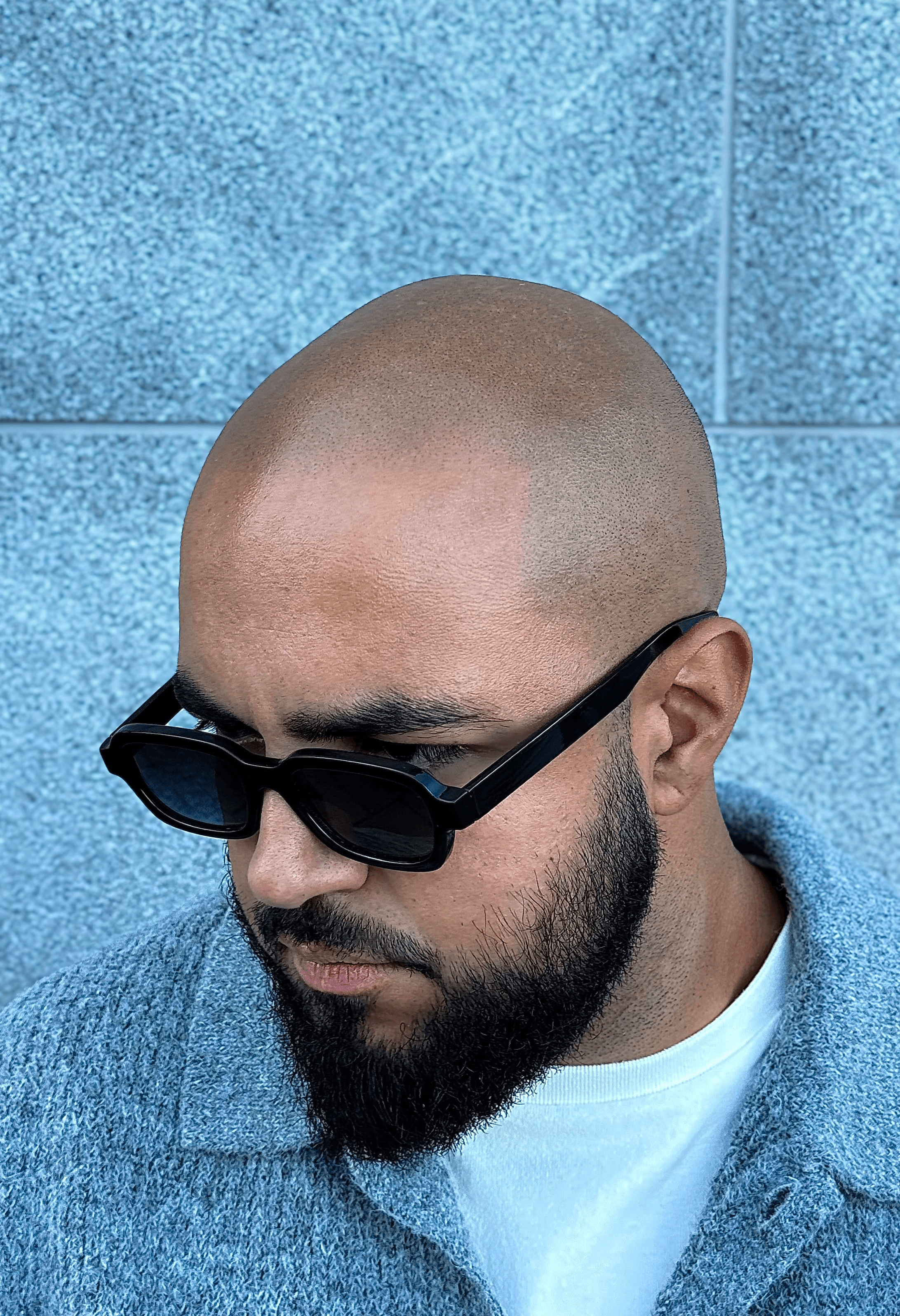 Scalp & Brows, Skalp Mikropigmentering i Stockholm