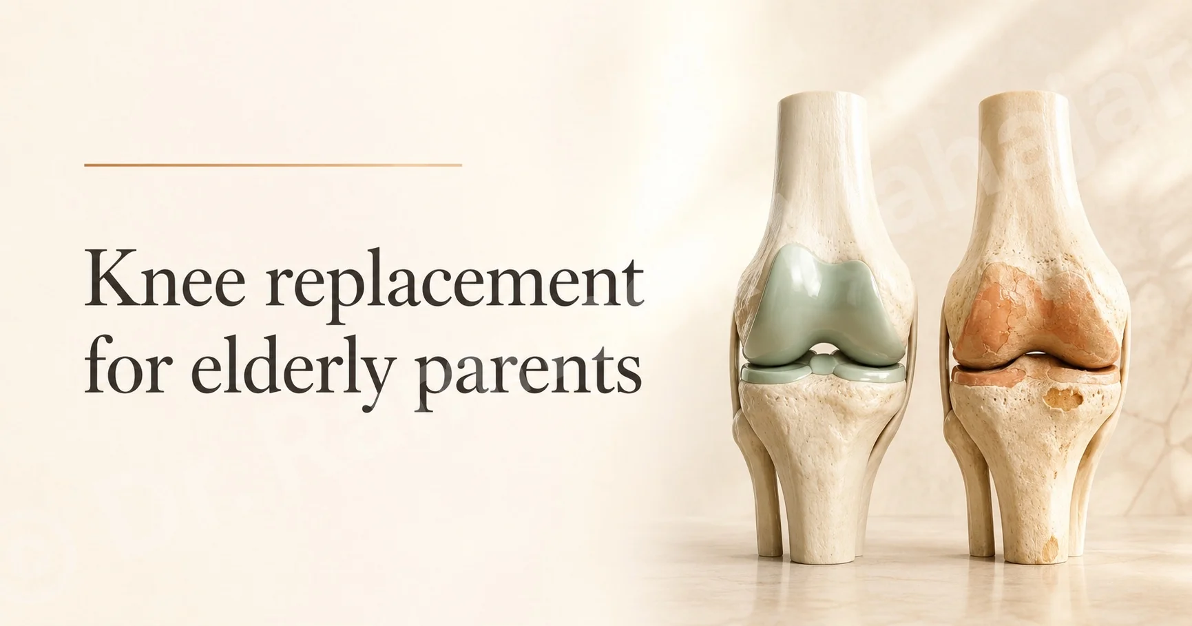 Dr Ramneek Mahajan's guide to knee replacement for elderly parents.