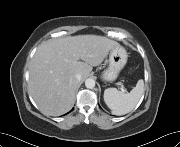 a gloved hand holding a test tube filled with liquid