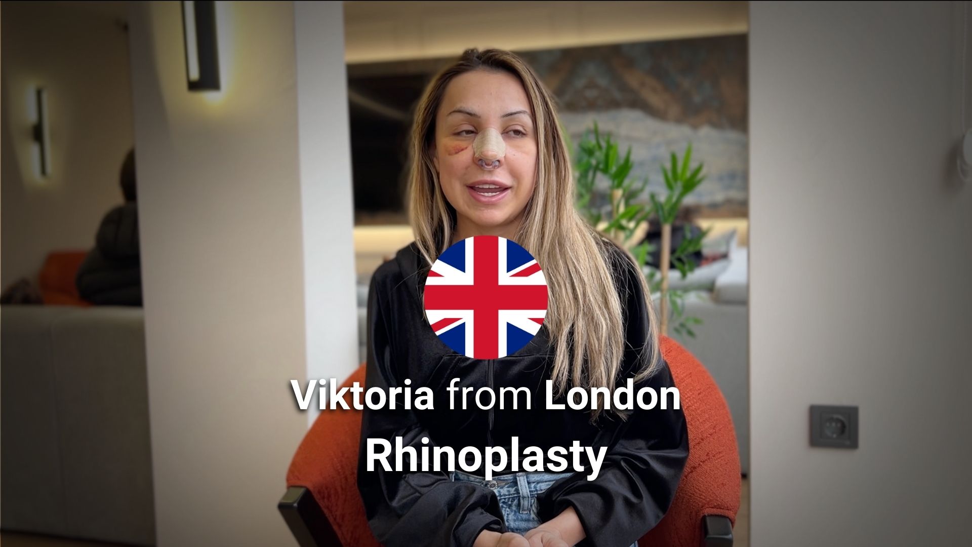 piezo rhinoplasty patient before after and review istanbul