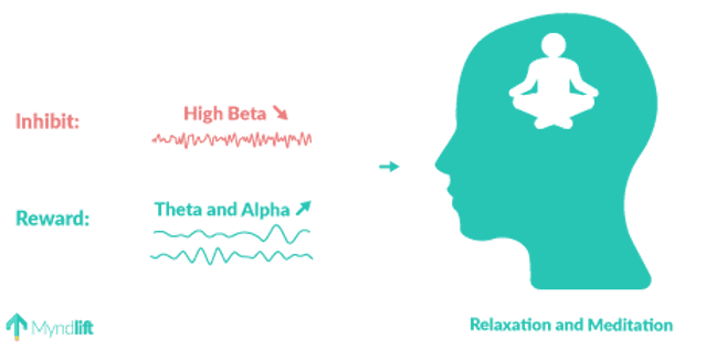 Neurofeedback protocol guide for anxiety reduction and mood stabilization