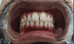 After Image