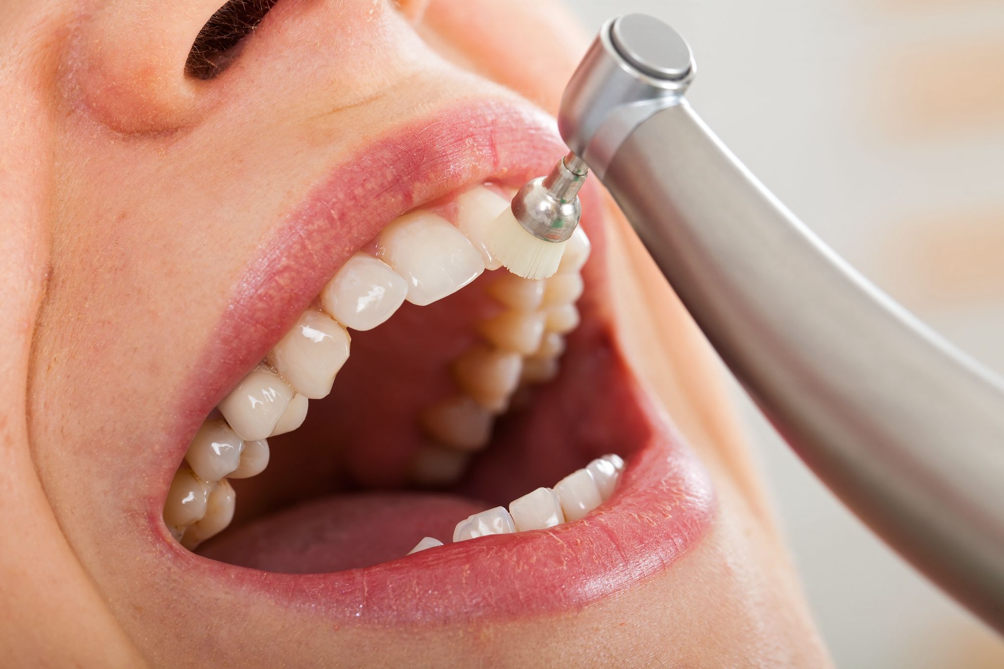 Mondhygiëne