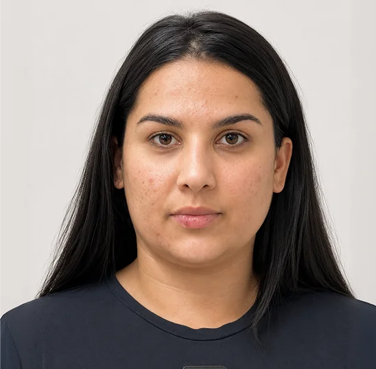 Retrato de rosto de uma jovem de cabelo escuro liso, antes do procedimento