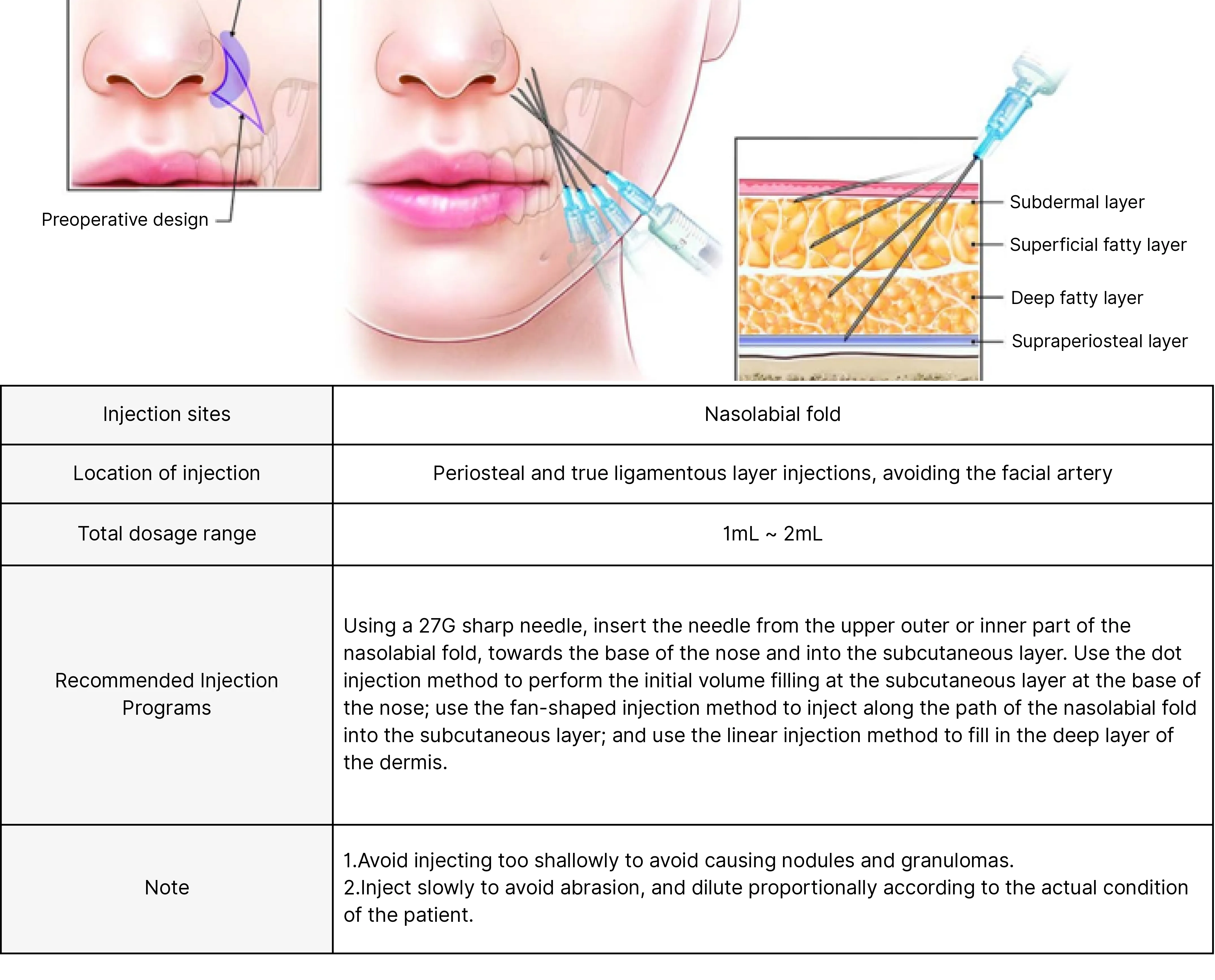 injection sites