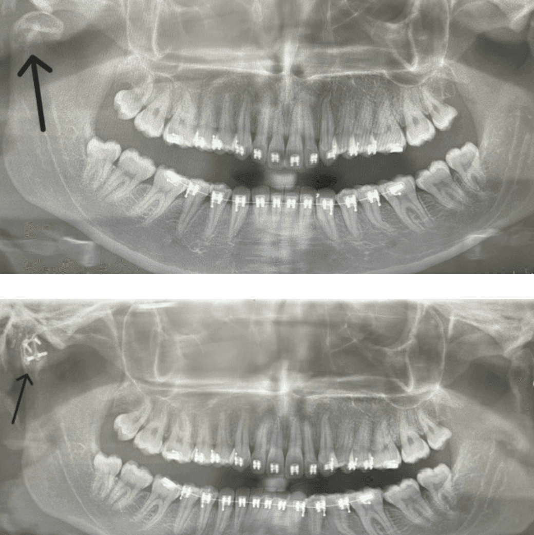 smiling happily caregiver hugging her old