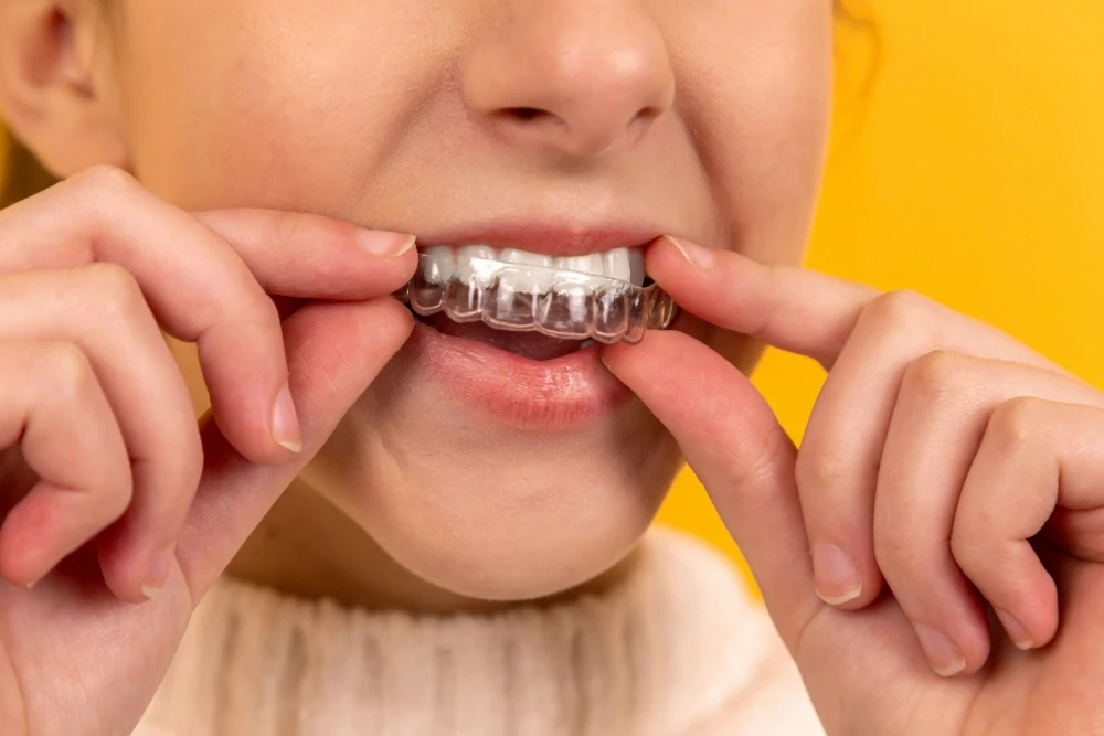 close-up photo, woman holding clear aligners