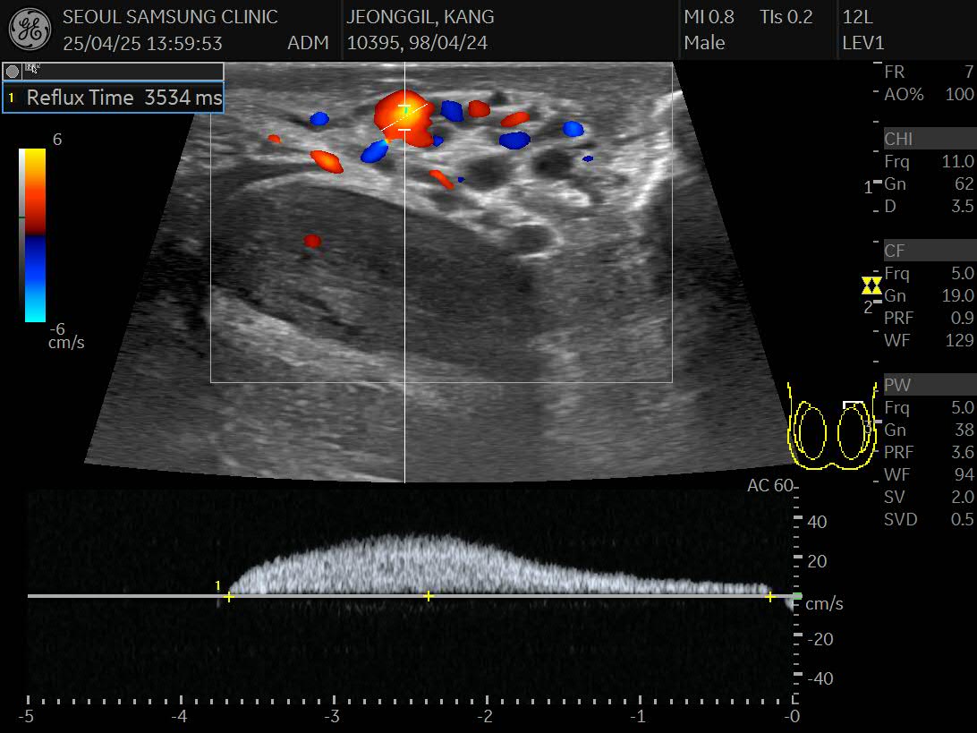 도플러 초음파 검사