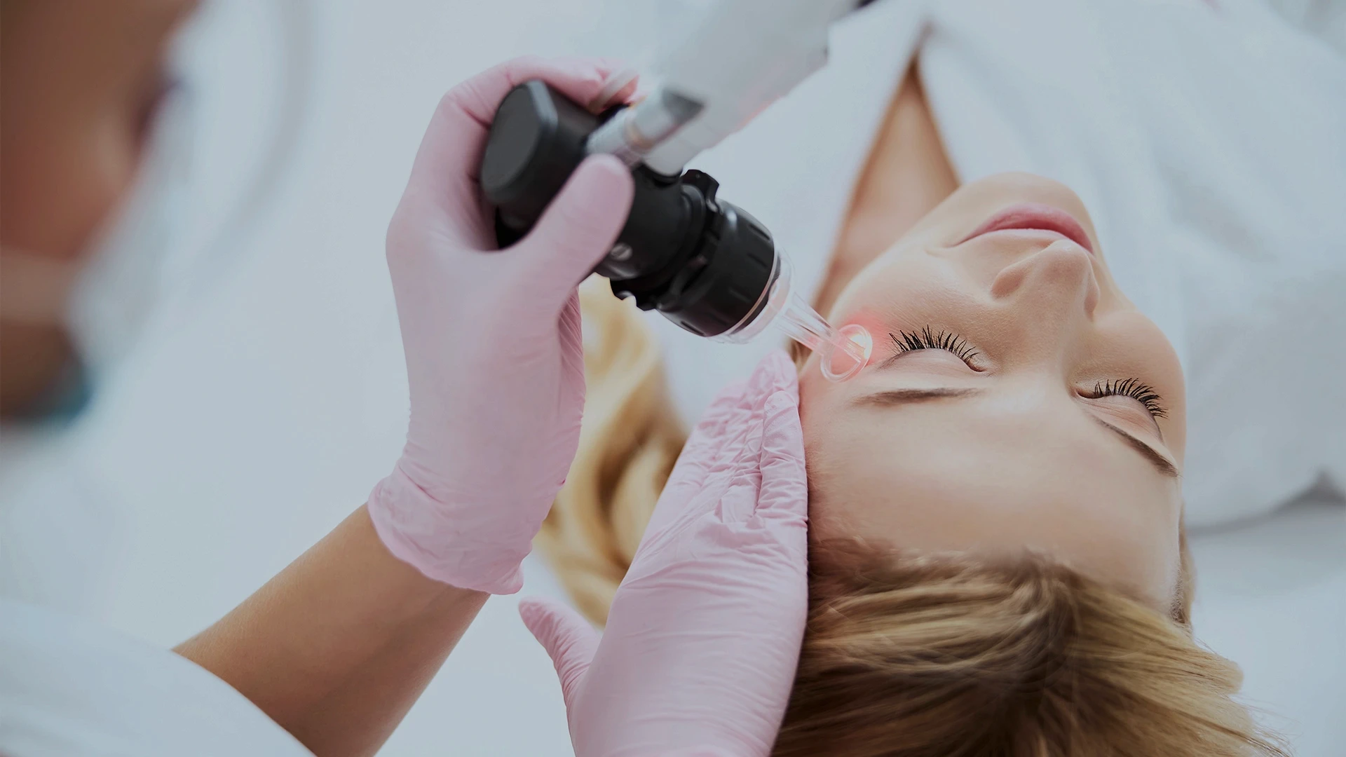 Warzen entfernen in der Türkei