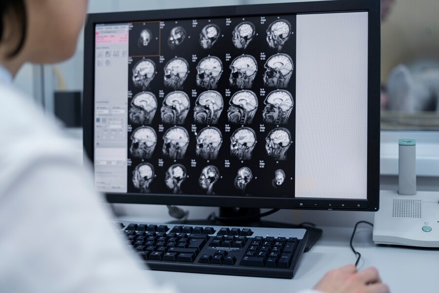 A doctor viewing brain scans or the CT scans of her patient.