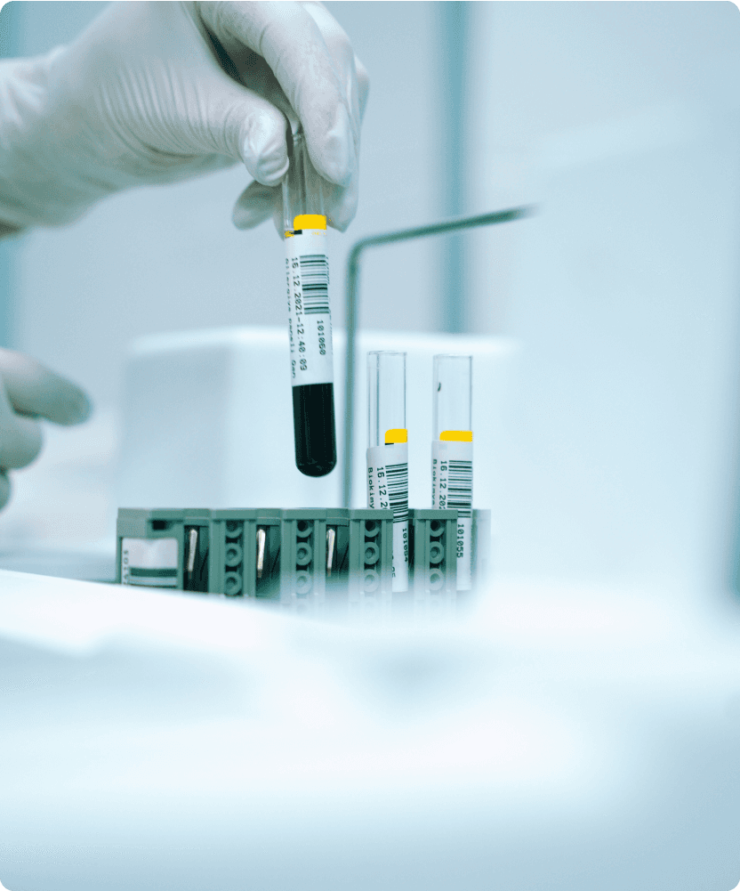 Blood analysis 