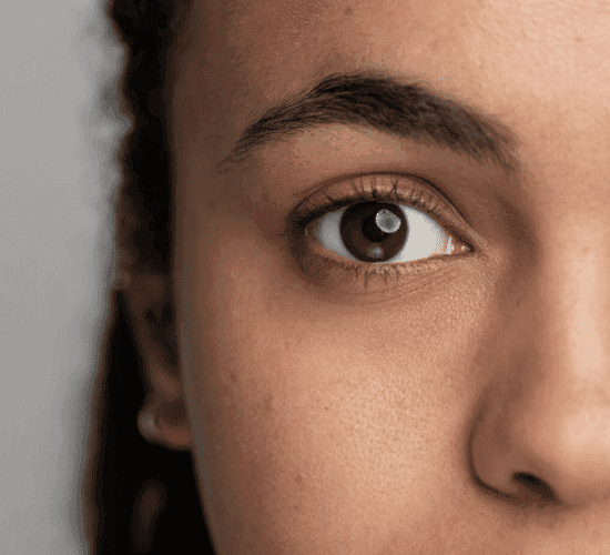 Síndrome de Sjögren "Sintomas oculares da síndrome de Sjögren"