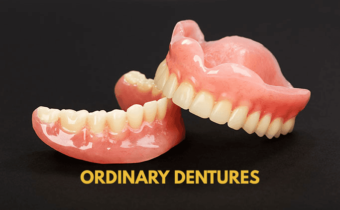 dental clinic davao matina crossing doctor showing sample of ordinary dentures