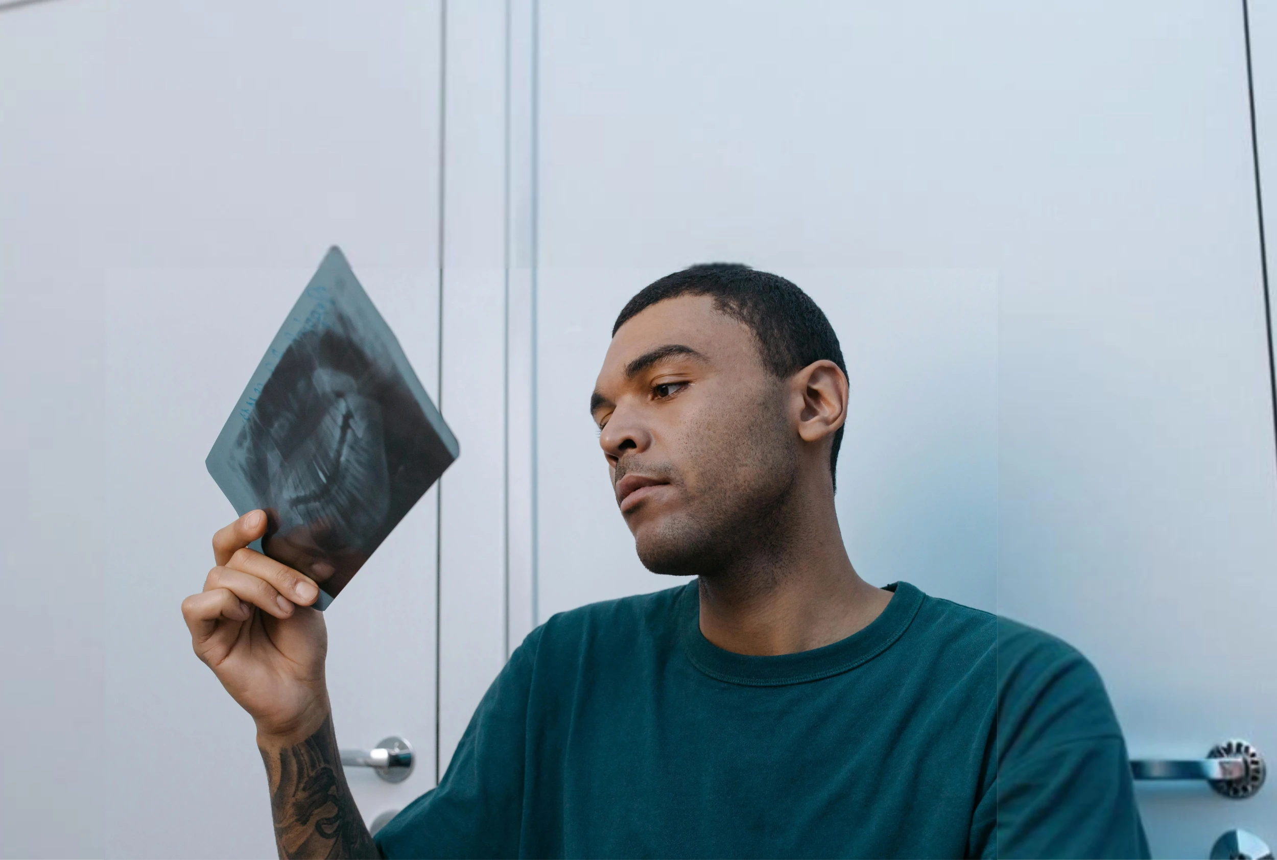 Tandröntgen vid rotbehandling