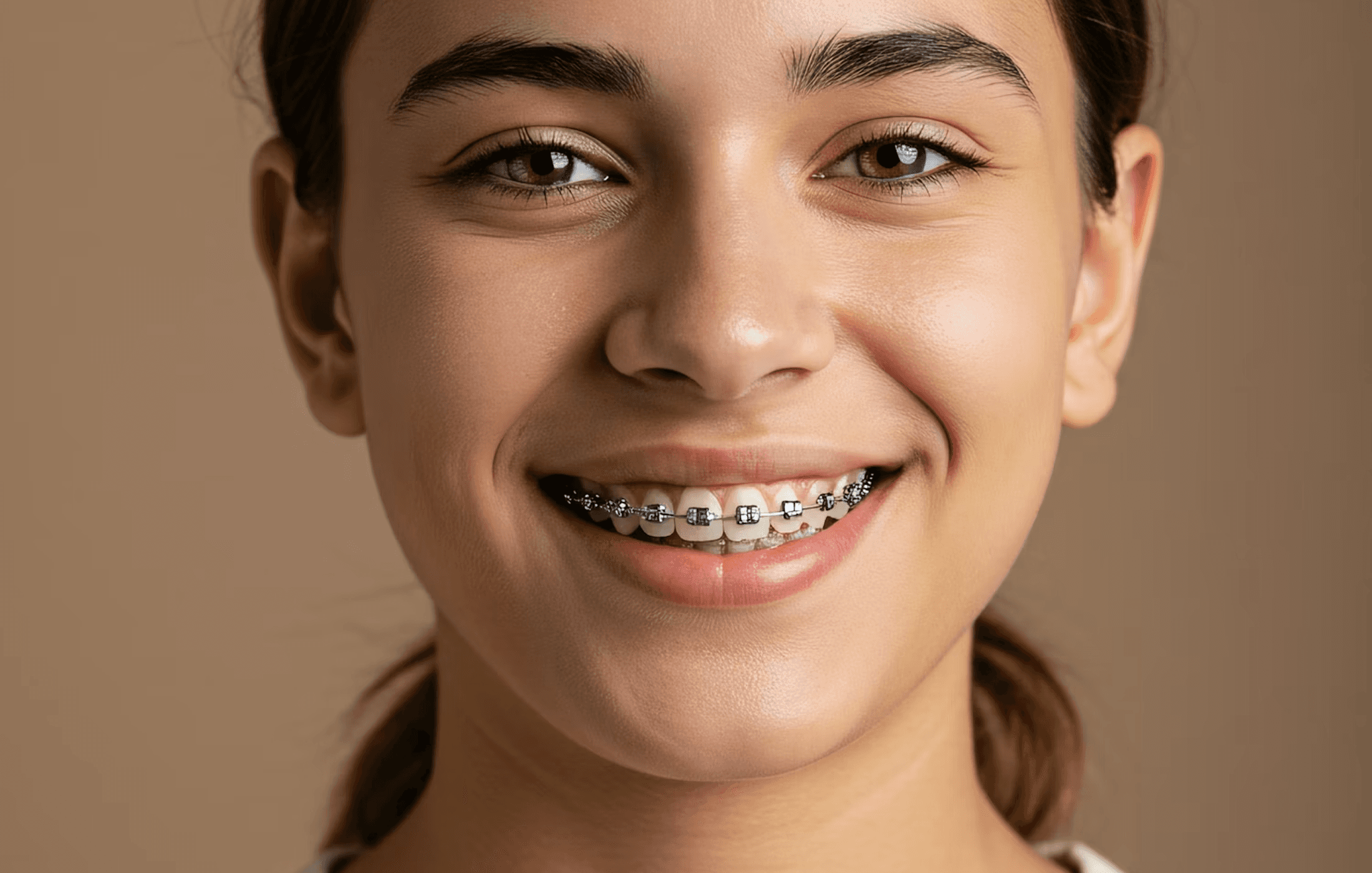 Close-up of smile showing yellowed teeth