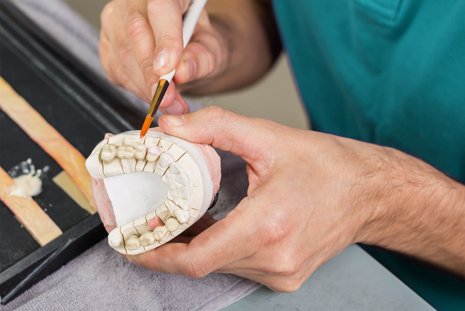 fabricacao-protese-dentaria