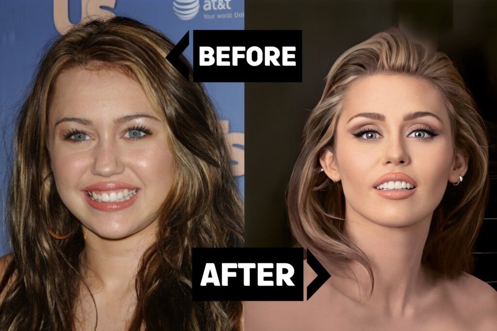 miley cyrus smile before and after